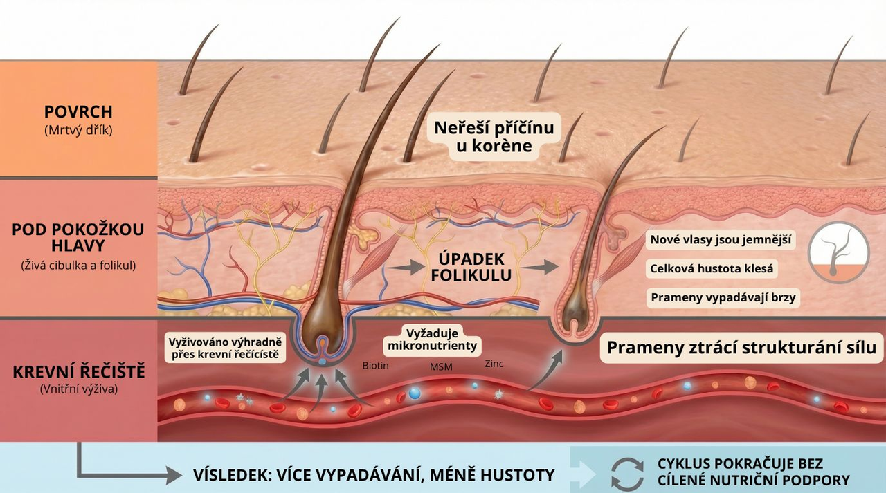 Lokální péče o vlasy nedokáže zabránit odumírání vlasových folikulů