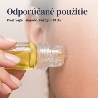 Micro-Infusion System