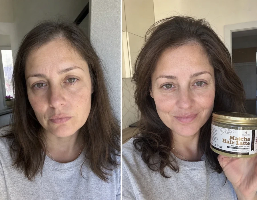 Woman before and after hair supplement use