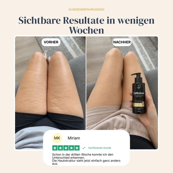 CelluLux