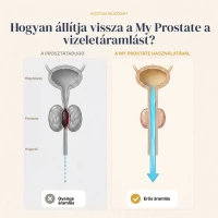 My Prostate