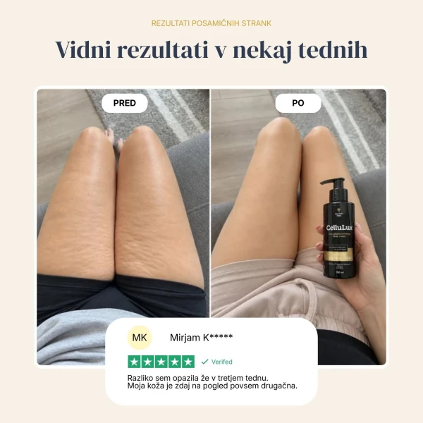 CelluLux