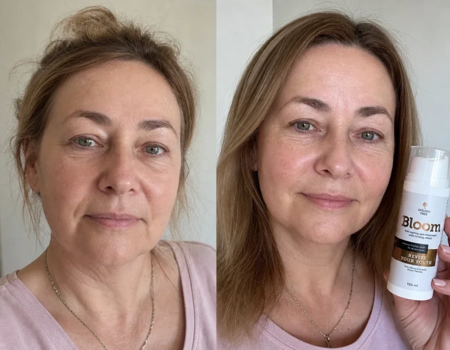Miriam s before and after facial skin