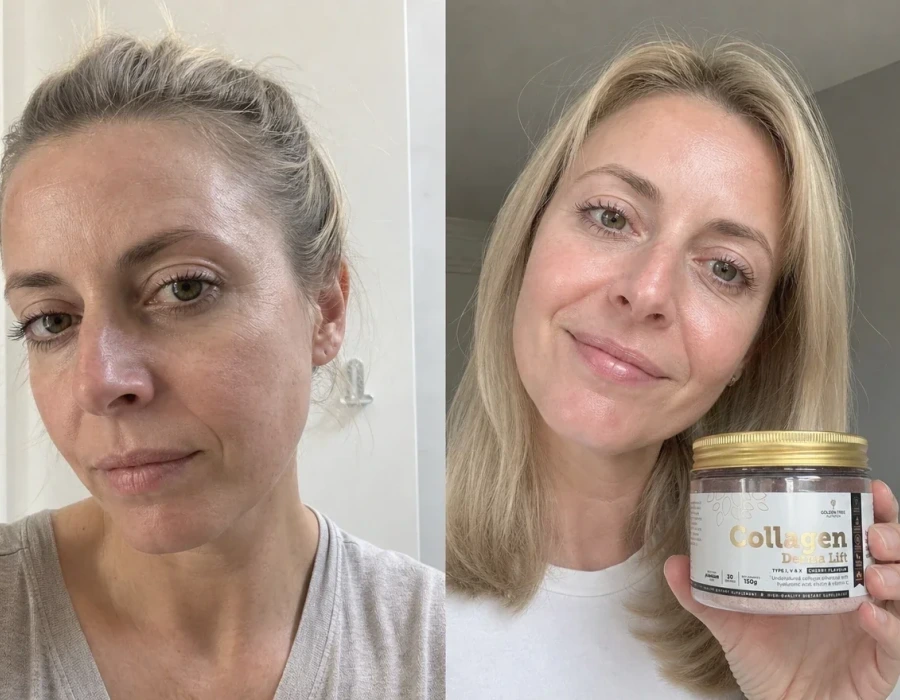 Donna bionda di 39 anni prima e dopo, luminosità della pelle del viso