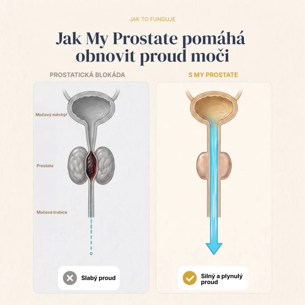 My Prostate