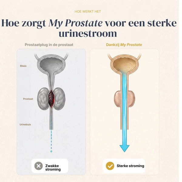 My Prostate