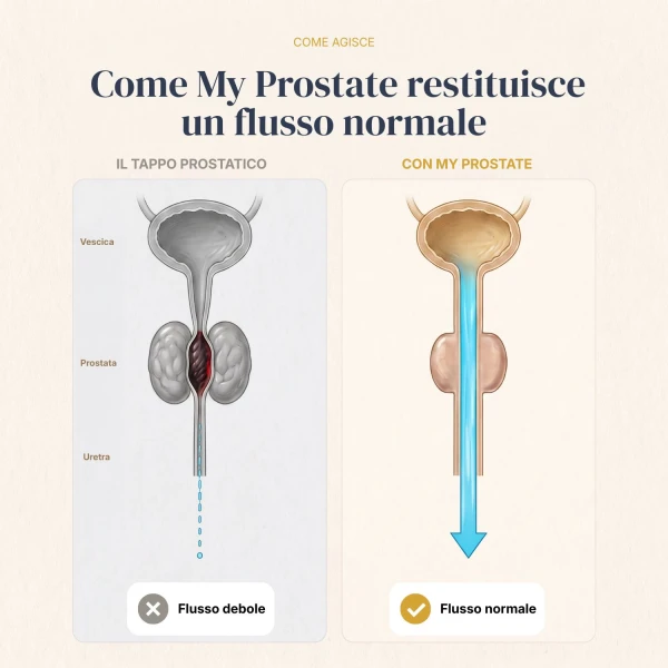 My Prostate