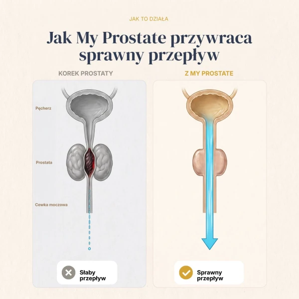 My Prostate