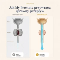 My Prostate