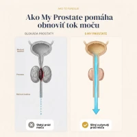 My Prostate