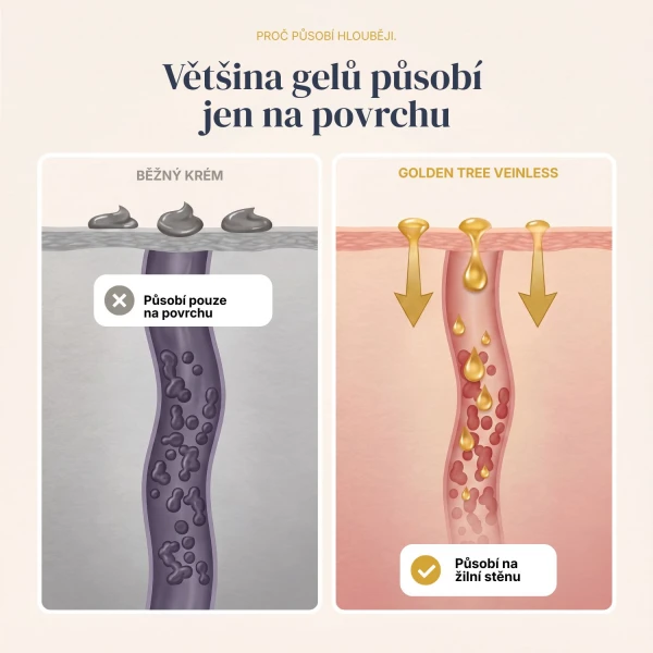 Veinless Gel