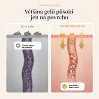 Veinless Gel