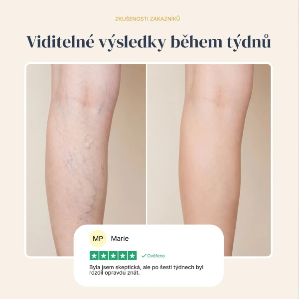 Veinless Gel