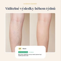 Veinless Gel