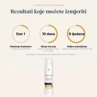 Veinless Gel