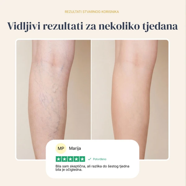 Veinless Gel