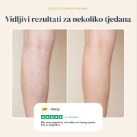Veinless Gel