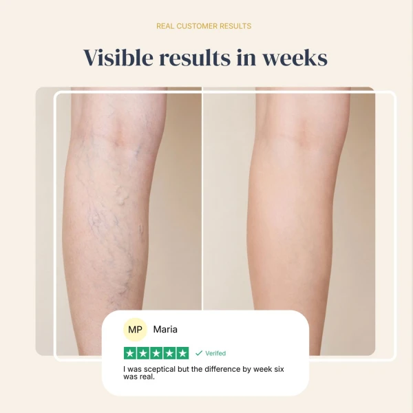 Veinless Gel
