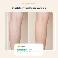 Veinless Gel