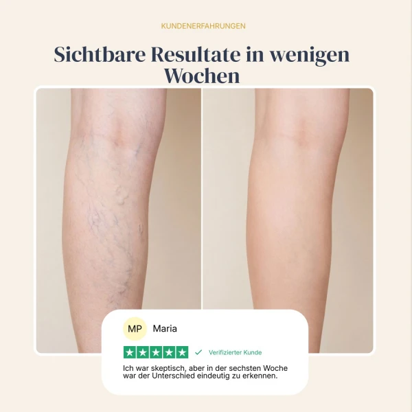 Veinless Gel