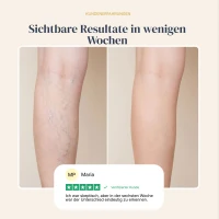 Veinless Gel