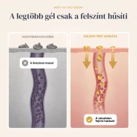 Veinless Gél Szüntesse meg a vénás torlódást, és nyerje vissza a könnyed, kényelmes lábérzetet!