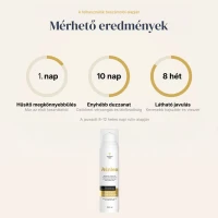 Veinless Gél Szüntesse meg a vénás torlódást, és nyerje vissza a könnyed, kényelmes lábérzetet!