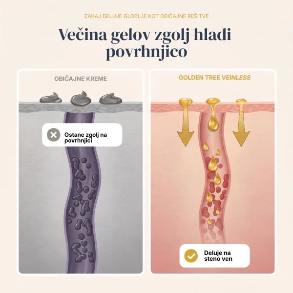 Veinless Gel
