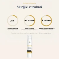 Veinless Gel