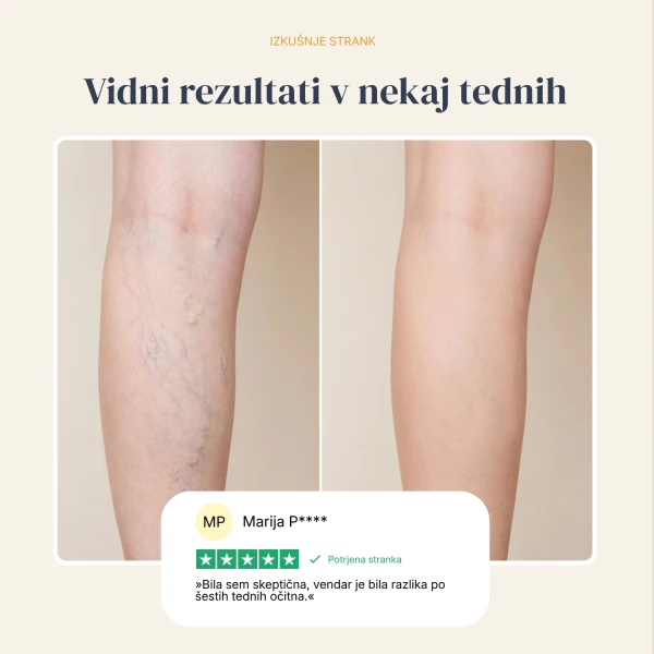Veinless Gel