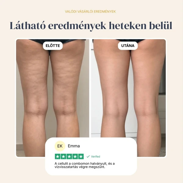 Lymph Relief Tisztítsd meg tested természetes vízelvezető csatornáit, és búcsút inthetsz a nehéz, duzzadt lábaknak.