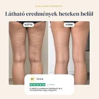Lymph Relief Tisztítsd meg tested természetes vízelvezető csatornáit, és búcsút inthetsz a nehéz, duzzadt lábaknak.