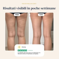 Lymph Relief