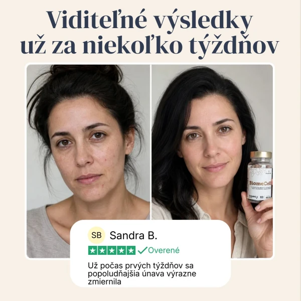 BiomeCell Prebiotický a probiotický prípravok na podporu črevnej mikroflóry
