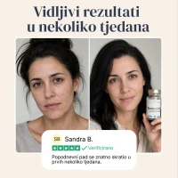 BiomeCell Formula s prebioticima i probioticima za crijevni mikrobiom