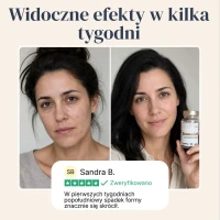 BiomeCell Preparat prebiotyczno-probiotyczny wspomagający mikroflorę jelitową