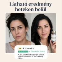 BiomeCell Prebiotikus rostok és élő baktériumkultúrák egy kapszulában