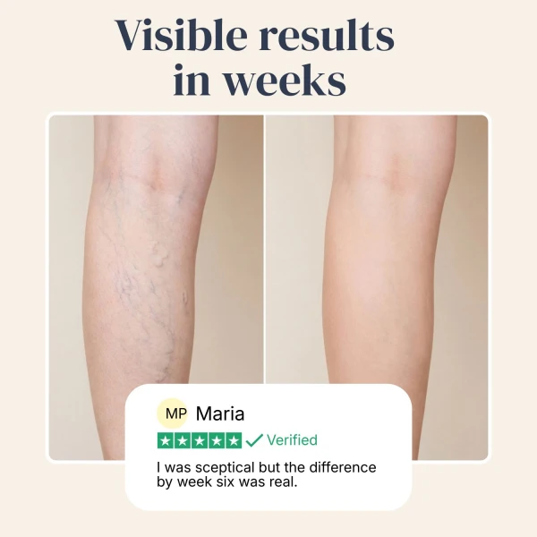 Veinless Gel