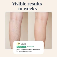 Veinless Gel