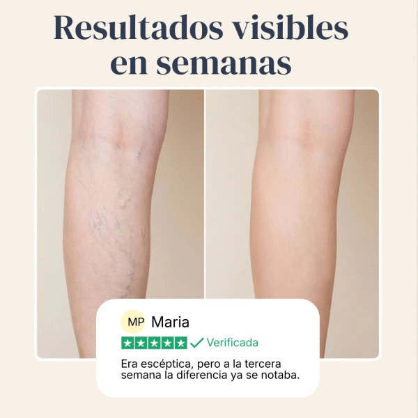 Veinless Gel