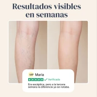 Veinless Gel