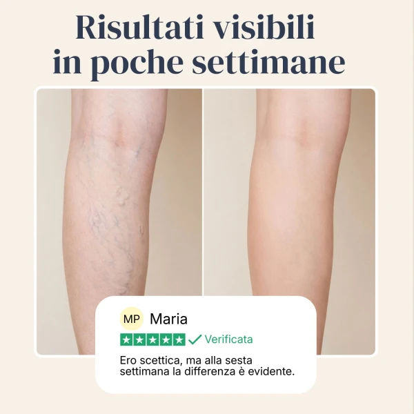 Veinless Gel