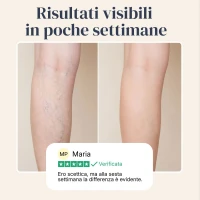 Veinless Gel