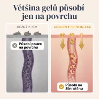 Veinless Gel