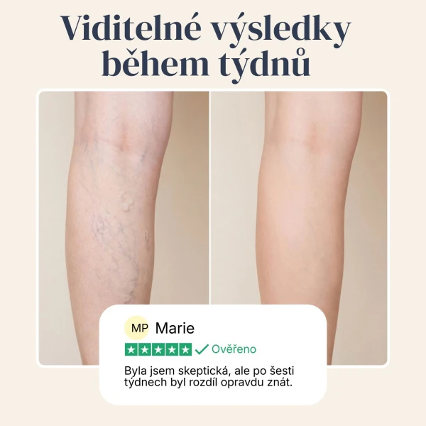 Veinless Gel