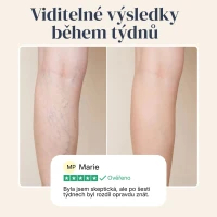Veinless Gel
