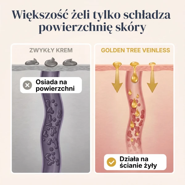 Veinless Żel