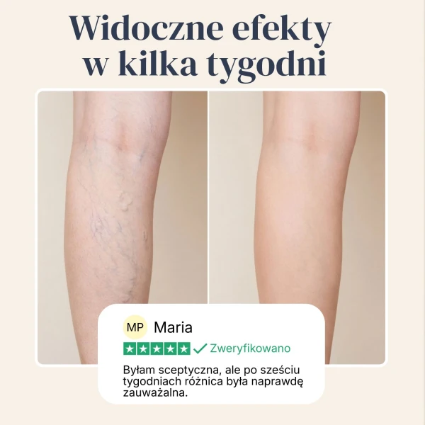 Veinless Żel