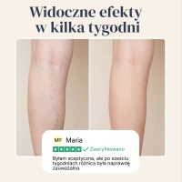 Veinless Żel