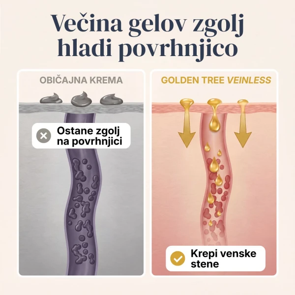 Veinless Gel